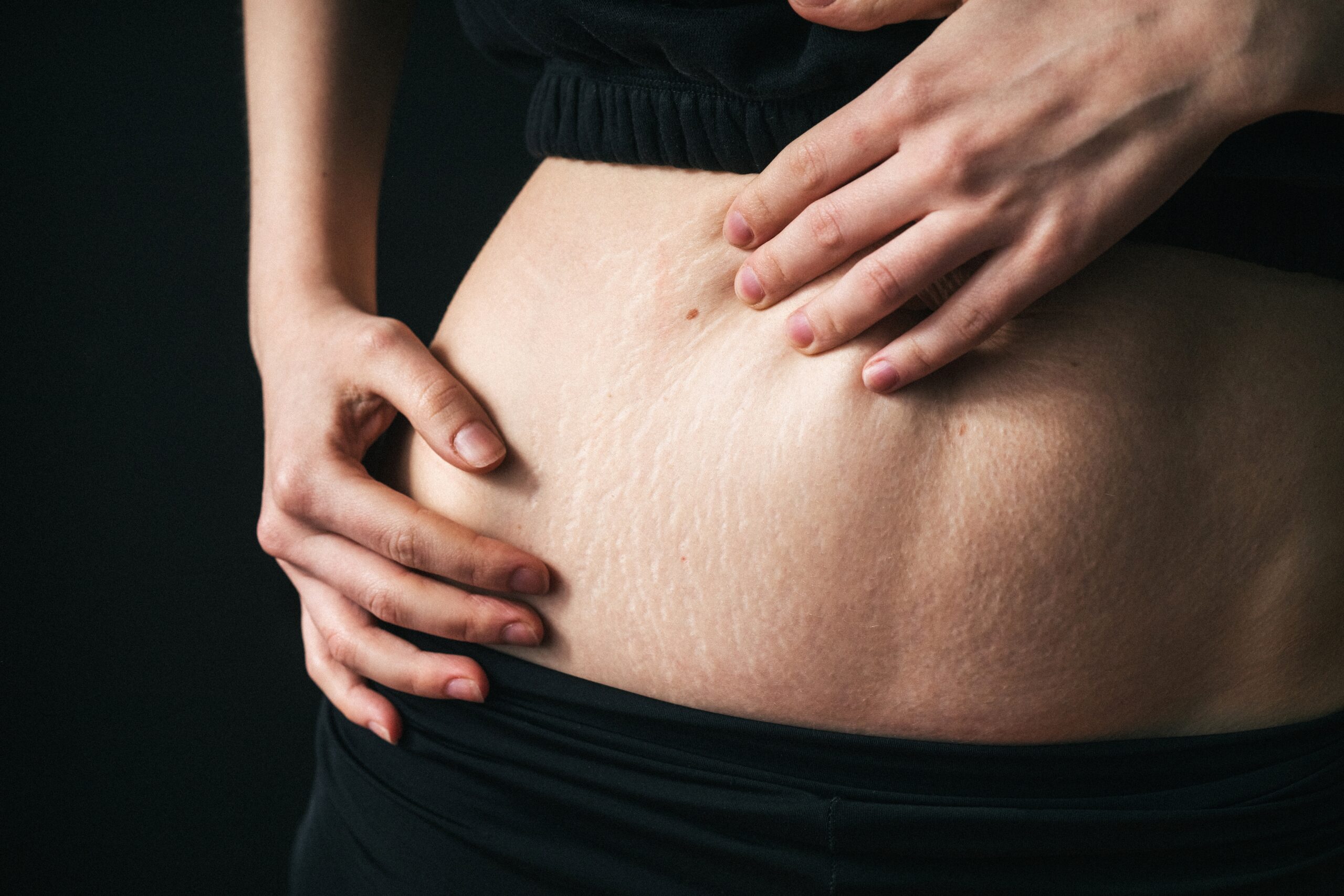 Conheça os tipos de gorduras e a sua importância no organismo humano